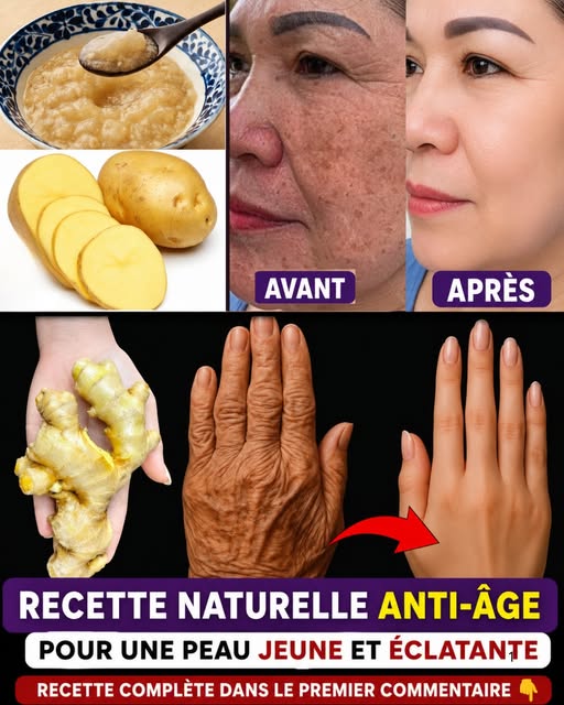 ✨ Éliminez les taches brunes et les rides avec ce simple remède à base de pomme de terre et de gingembre 🥔