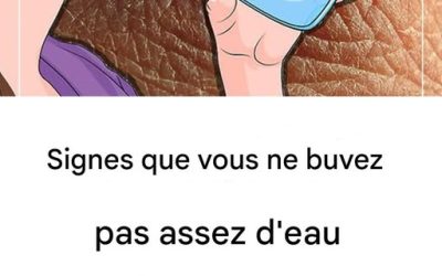 C’est ce qui se passe lorsque vous ne buvez pas assez d’eau