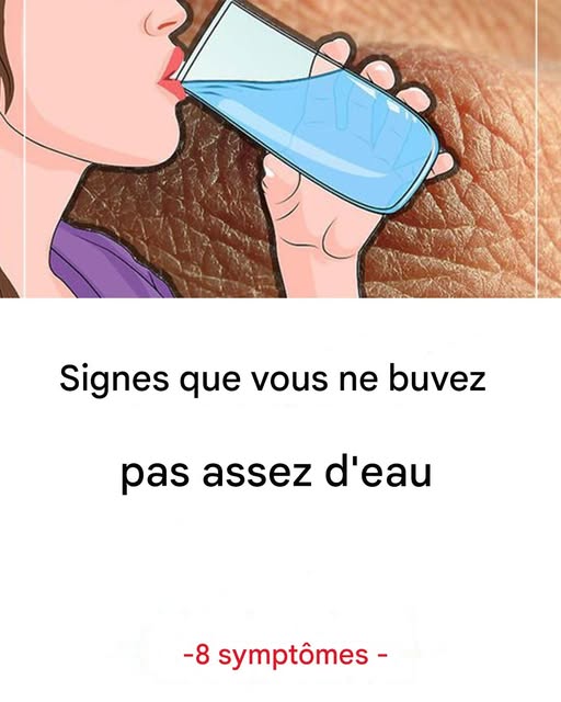 C’est ce qui se passe lorsque vous ne buvez pas assez d’eau