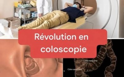 Coloscopie Révolutionnaire : Fini l’Examen Invasif, Place à la Méthode Virtuelle