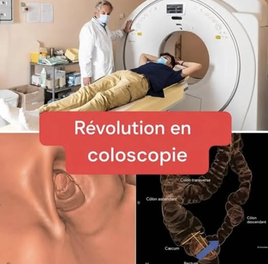 Coloscopie Révolutionnaire : Fini l’Examen Invasif, Place à la Méthode Virtuelle