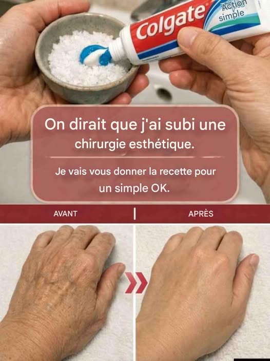 Comment le dentifrice peut améliorer naturellement l’apparence des taches de vieillesse et des rides