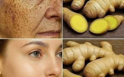 Le gingembre est 100 fois plus efficace que le Botox pour estomper les rides profondes, les taches de rousseur et les imperfections pigmentaires. Je tenais à vous le dire pour que vous continuiez à recevoir mes recettes… Merci ! 😍