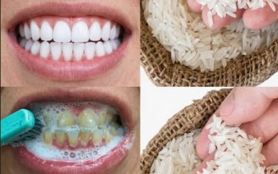 Le sourire éclatant en soixante secondes : la méthode méconnue à base de riz