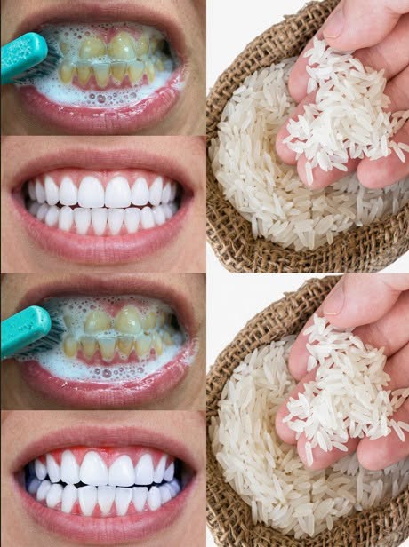 Le sourire éclatant en soixante secondes : la méthode méconnue à base de riz